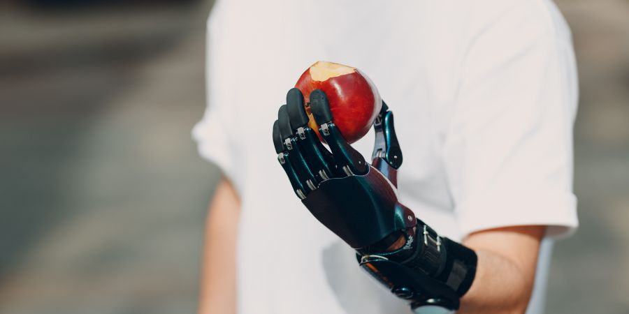 Bionic Prosthetics Image